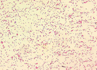 Protect your cattle against brucellosis