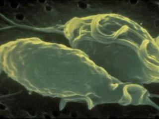 Managing trichomoniasis Managing trichomoniasis