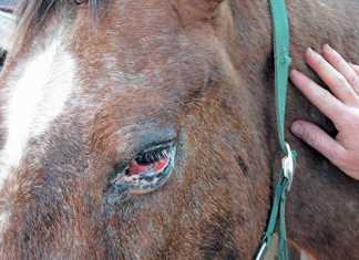 eye-infection