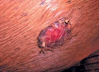 Dealing-with-equine-sarcoids