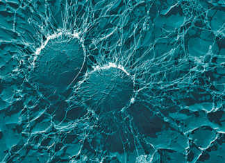 Bacterial cells of Staphylococcus aureus,