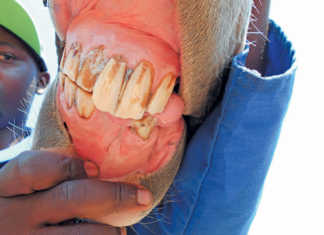 Dealing with a fractured jaw