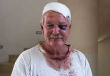 Charles Back still positive after brutal farm attack