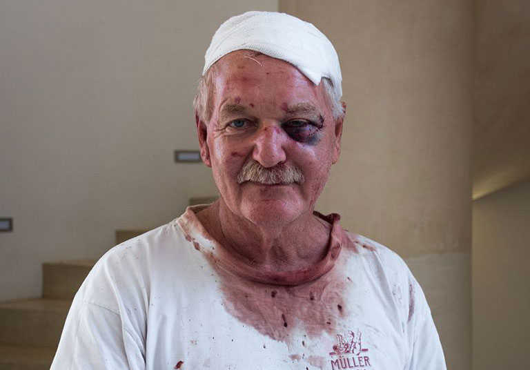 Charles Back still positive after brutal farm attack Charles Back still positive after brutal farm attack