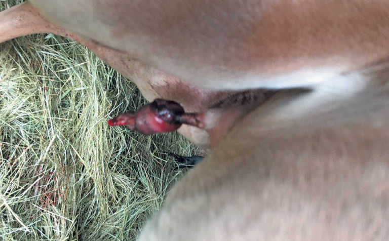 Severing the umbilical cord Severing the umbilical cord