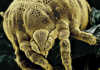 A mite